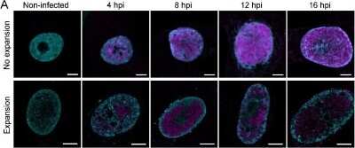 Immunocytochemistry/ Immunofluorescence: Histone H3 [Trimethyl Lys9] Antibody [NB21-1073]